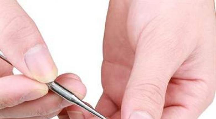 Ногти слоятся и ломаются: причины проблемы и лечение Форма ногтей и здоровье